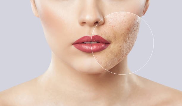 Does Makeup Damage Skin Permanently? Dermatologists Reveal the Truth